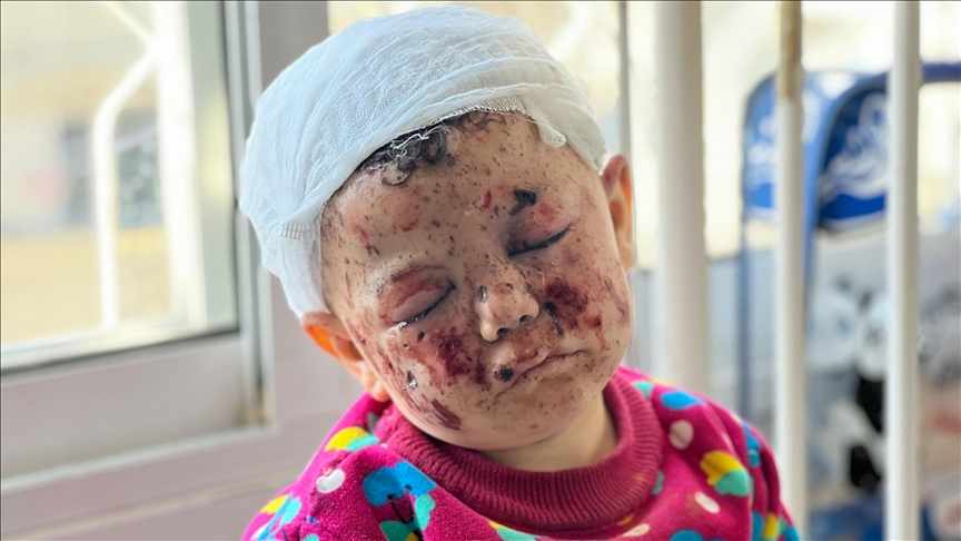 Gazze'de İsrail'in saldırılarında 5 kardeşi ölen kendisi de yaralanan Musab bebeğin hali yürek burktu