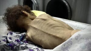 İsrail'in kıtlığı dayattığı Gazze Şeridi'nde son 24 saatte 2’si çocuk 4 kişi daha açlıktan hayatını kaybetti