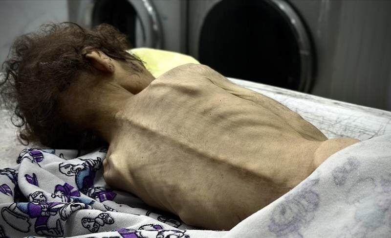 İsrail'in kıtlığı dayattığı Gazze Şeridi'nde son 24 saatte 2’si çocuk 4 kişi daha açlıktan hayatını kaybetti